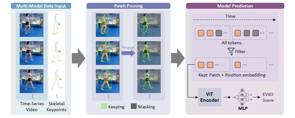 ChildGait-Video framework: multi-modal input, mask-guided patch pruning, and ViT encoder with MLP head predicting the EVGS score